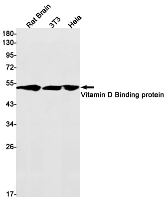 Anti-Vitamin D Binding Protein Rabbit Monoclonal Antibody