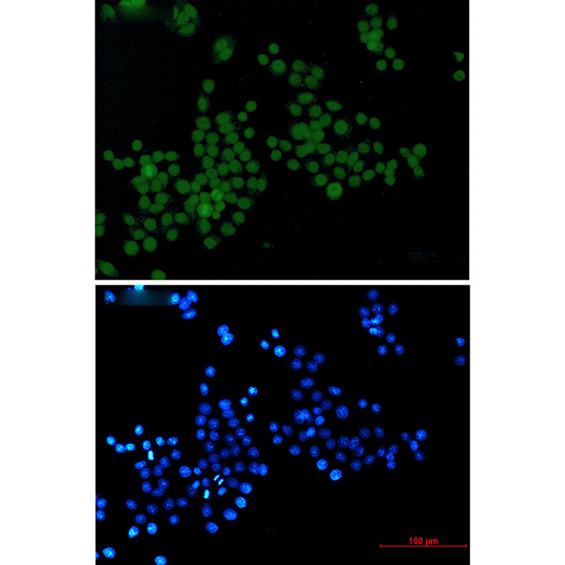 Anti-Phospho-Histone H3 (Ser10/Thr11) Rabbit Monoclonal Antibody