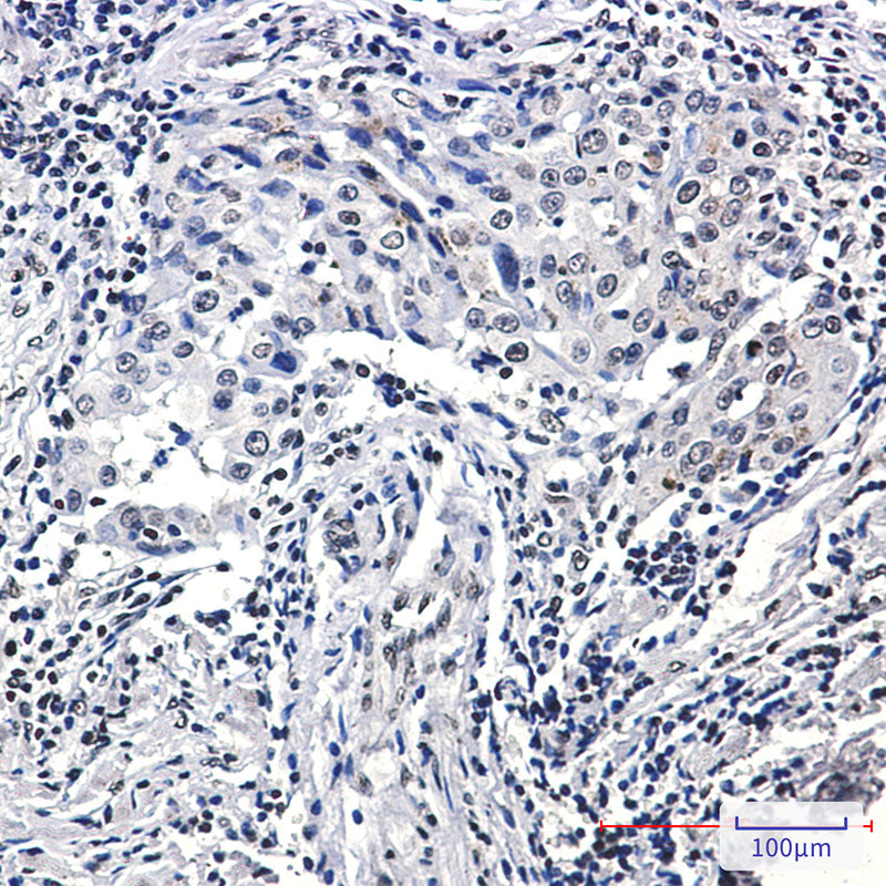Anti-Phospho-Histone H3 (Ser10/Thr11) Rabbit Monoclonal Antibody