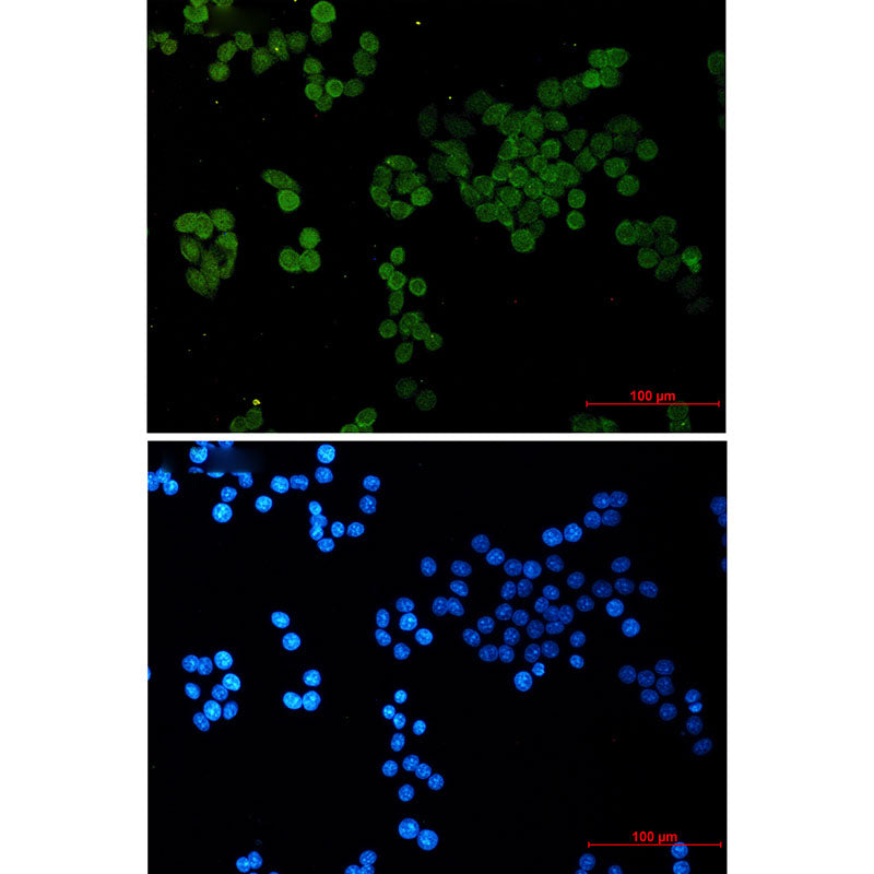 Anti-CRCP Rabbit Monoclonal Antibody