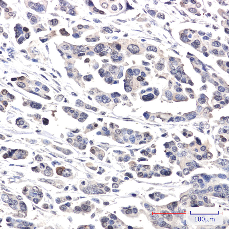 Anti-CRCP Rabbit Monoclonal Antibody