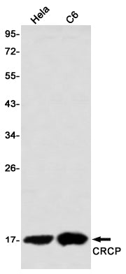 Anti-CRCP Rabbit Monoclonal Antibody