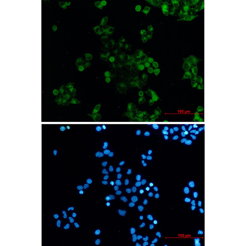 Anti-DAB2 Rabbit Monoclonal Antibody