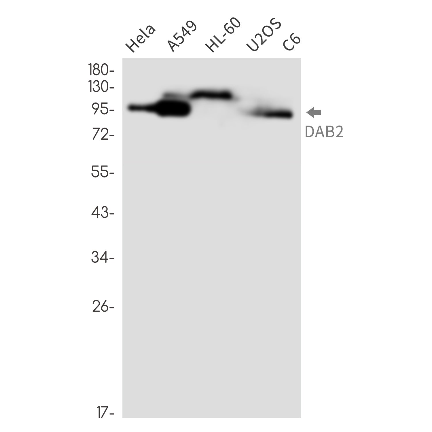 Anti-DAB2 Rabbit Monoclonal Antibody