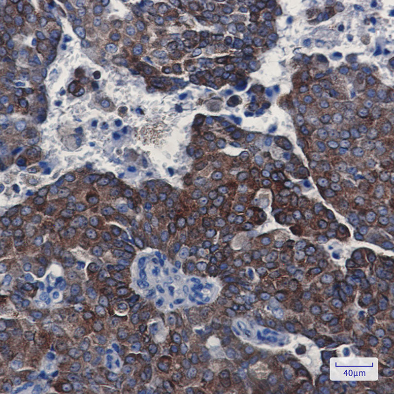 Anti-Bcl2 Rabbit Monoclonal Antibody