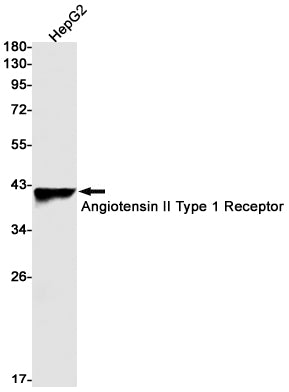 Anti-Angiotensin II Type 1 Receptor Rabbit Monoclonal Antibody