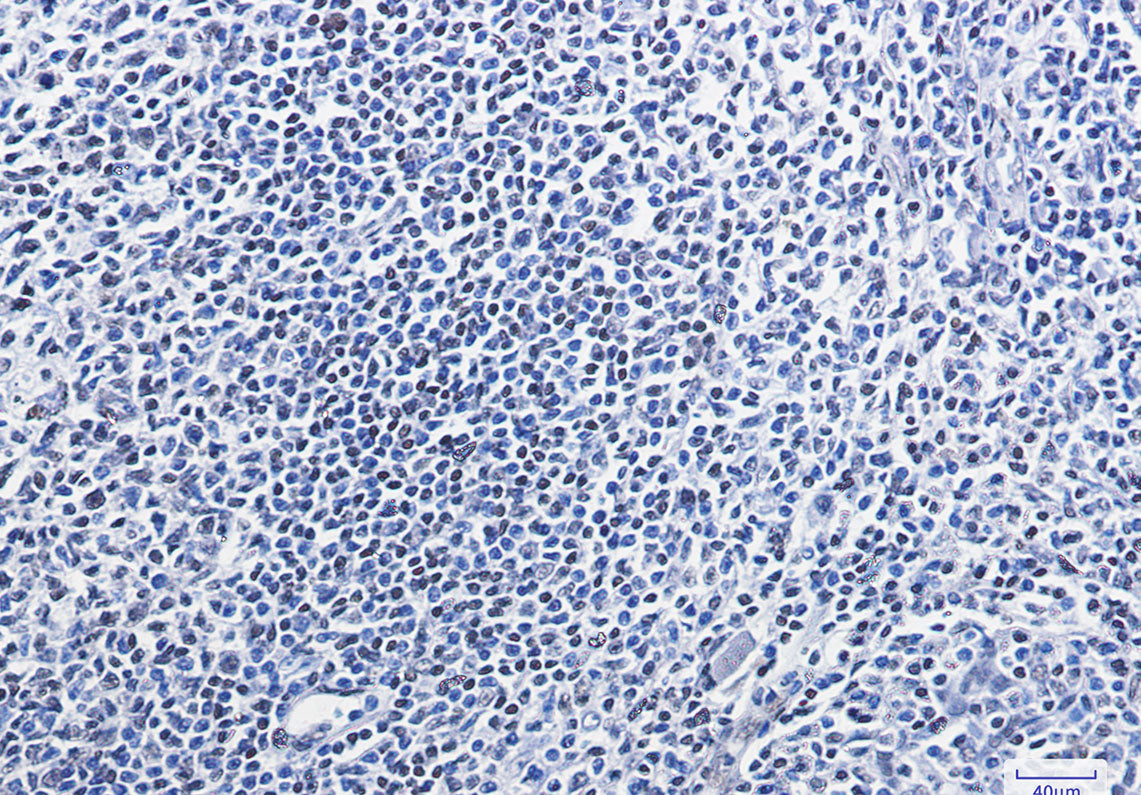 Anti-HMGB1 Rabbit Monoclonal Antibody