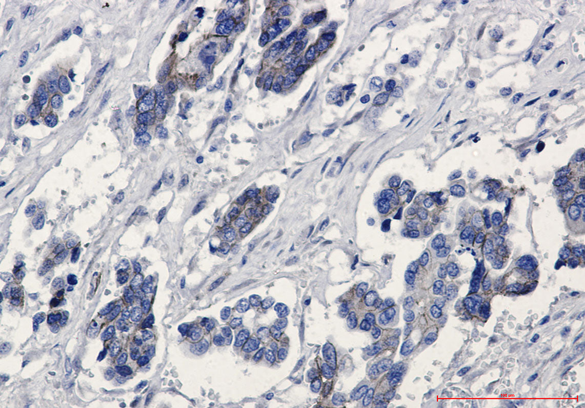 Anti-beta Catenin Rabbit Monoclonal Antibody