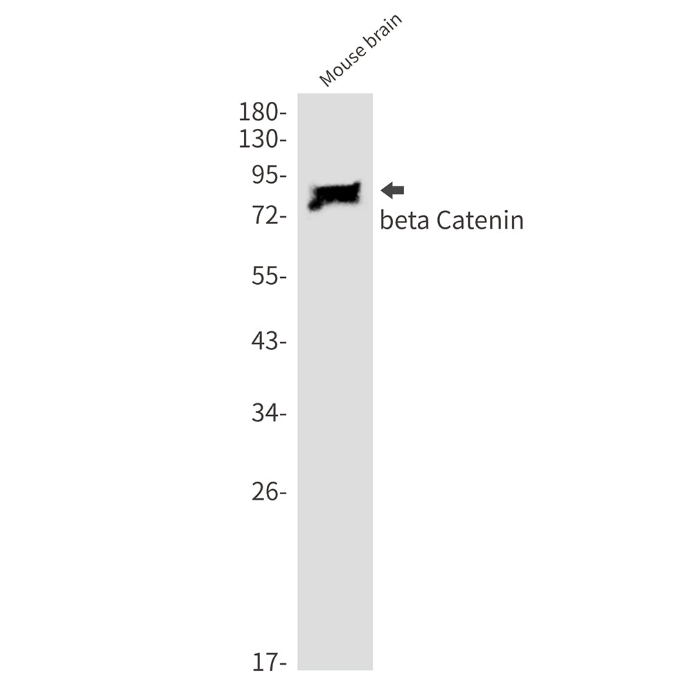 Anti-beta Catenin Rabbit Monoclonal Antibody