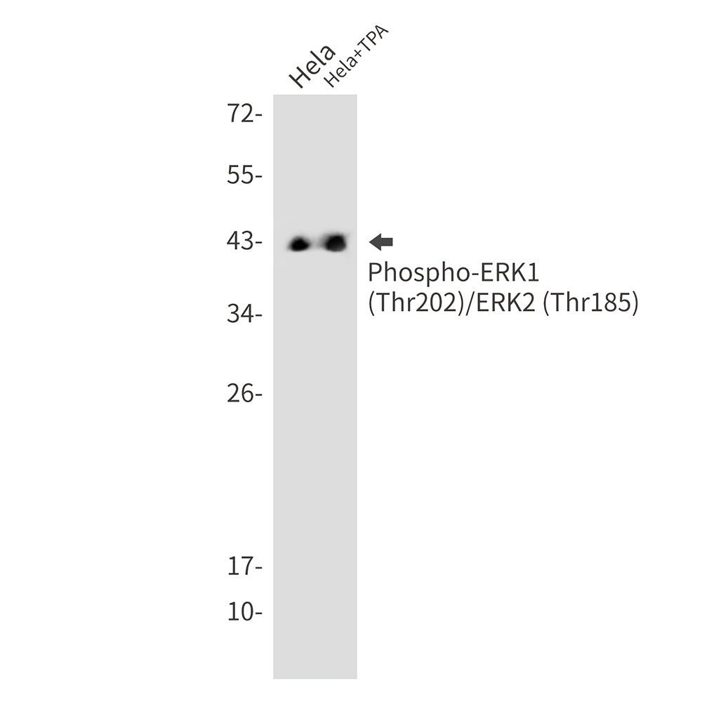 Anti-Phospho-ERK1/2 (Thr202/Thr185) Rabbit Monoclonal Antibody