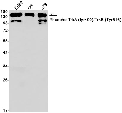Anti-Phospho-TrkA/B (Tyr490/Tyr516) Rabbit Monoclonal Antibody