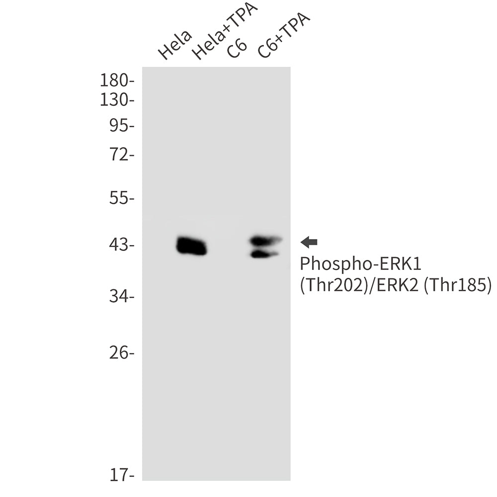 Anti-Phospho-ERK1/2 (Thr202/Thr185) Rabbit Monoclonal Antibody