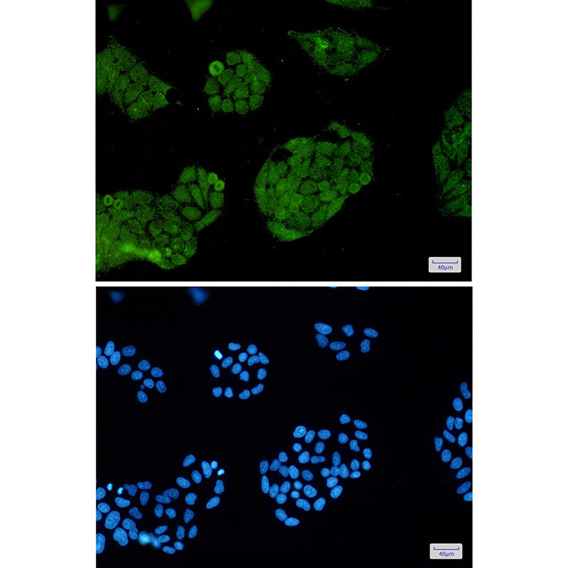 Anti-FOXO1 Rabbit Monoclonal Antibody
