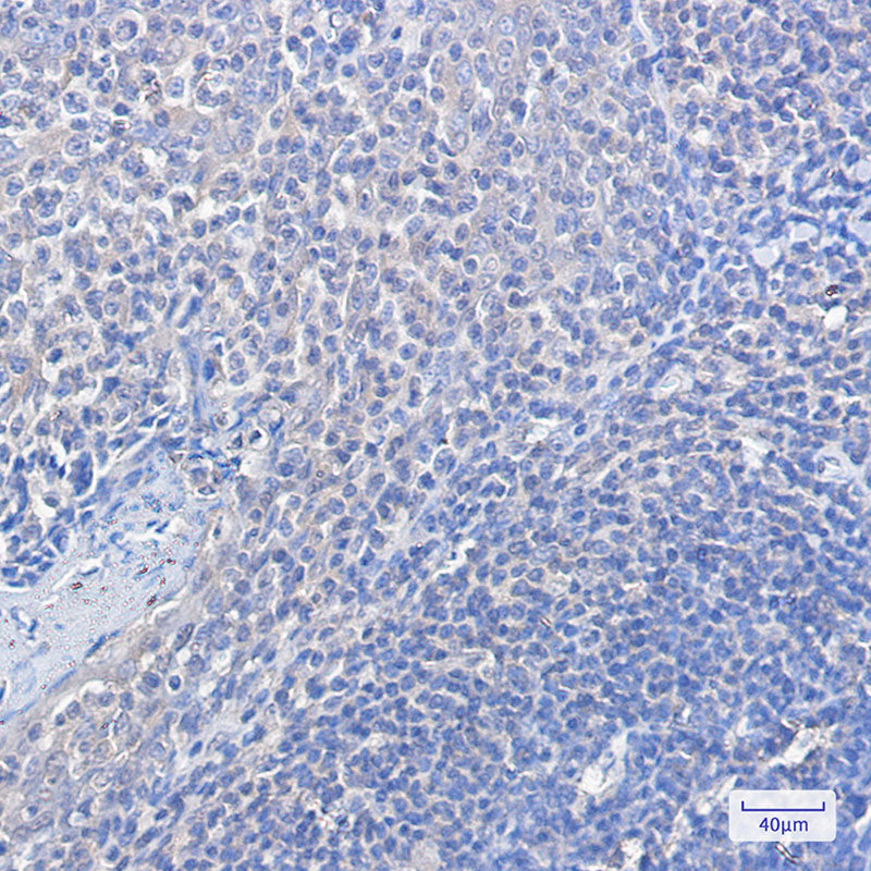 Anti-FOXO1 Rabbit Monoclonal Antibody