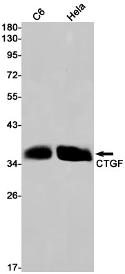Anti-CTGF Rabbit Monoclonal Antibody
