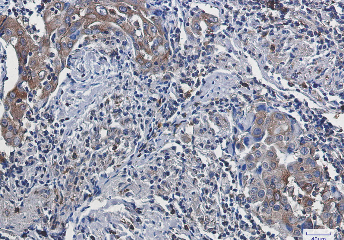 Anti-FACL4 Rabbit Monoclonal Antibody