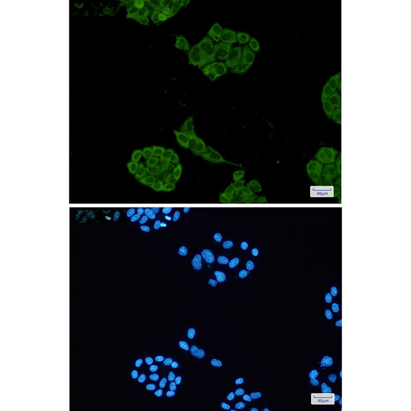 Anti-Lactate Dehydrogenase A Rabbit Monoclonal Antibody