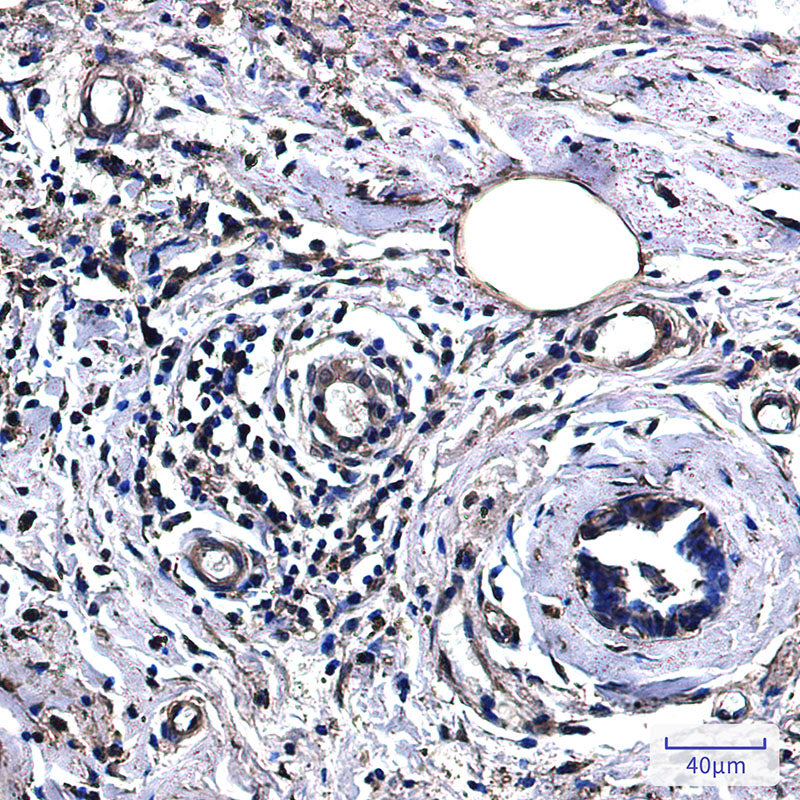 Anti-Lactate Dehydrogenase A Rabbit Monoclonal Antibody