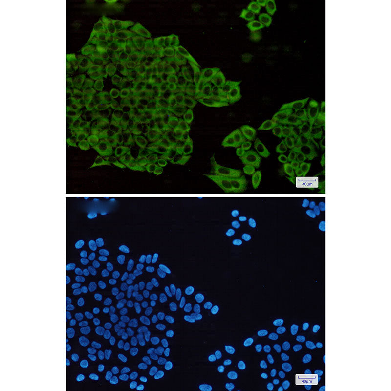 Anti-MEK1/2 Rabbit Monoclonal Antibody
