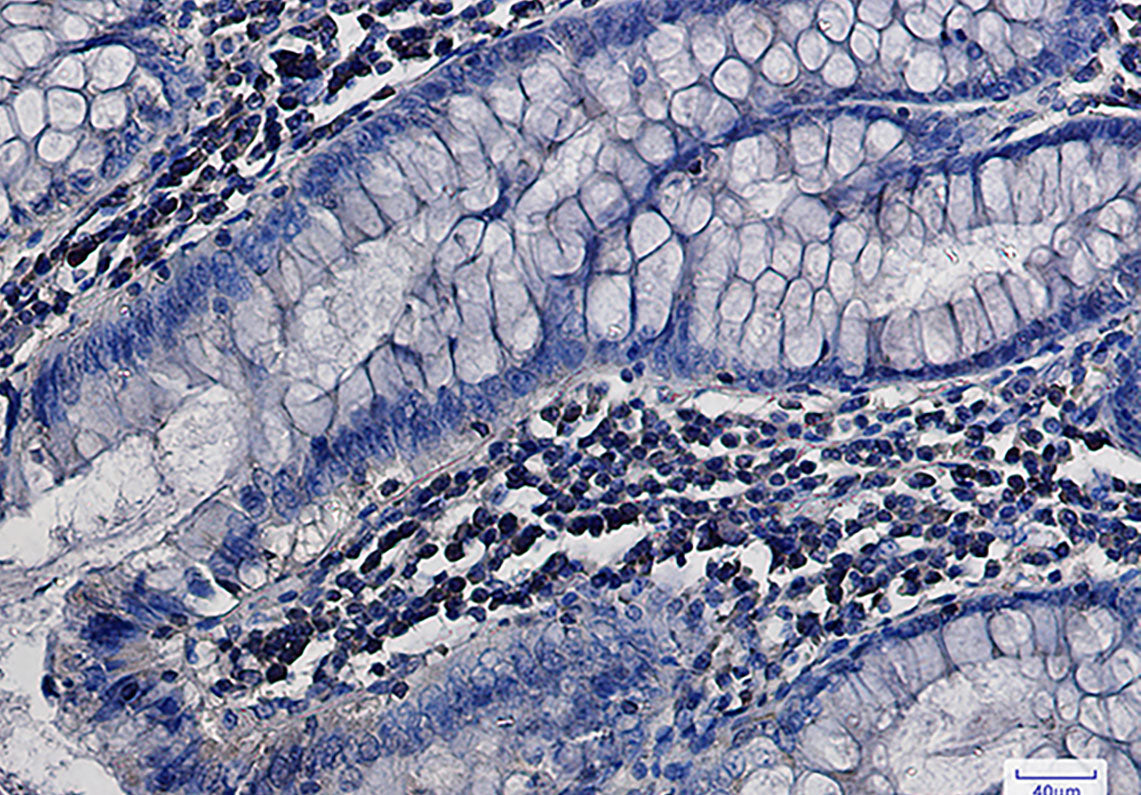 Anti-MEK1/2 Rabbit Monoclonal Antibody