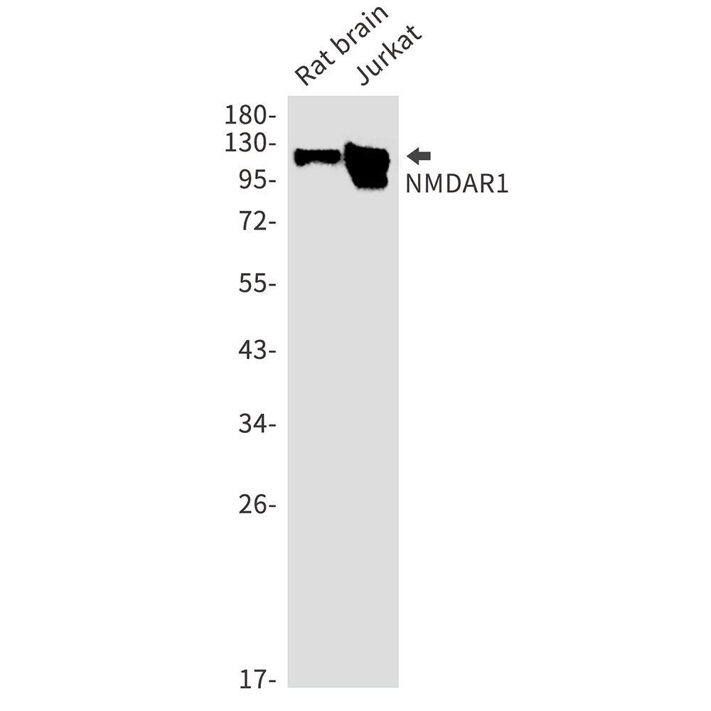 Anti-NMDAR1 Rabbit Monoclonal Antibody