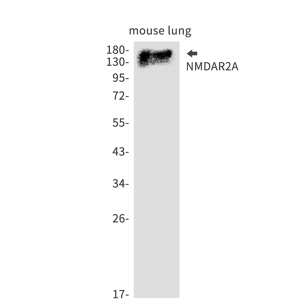 Anti-NMDAR2A Rabbit Monoclonal Antibody