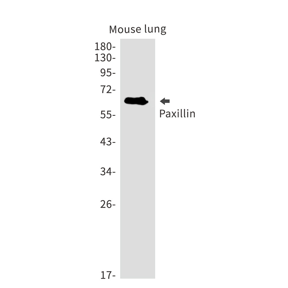 Anti-Paxillin Rabbit Monoclonal Antibody