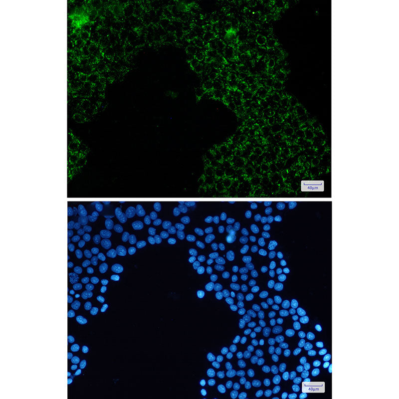 Anti-Pyruvate Dehydrogenase E1 alpha Rabbit Monoclonal Antibody