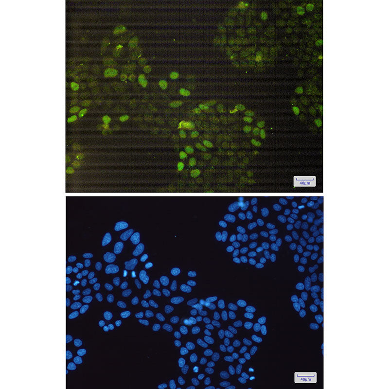 Anti-Rb Rabbit Monoclonal Antibody