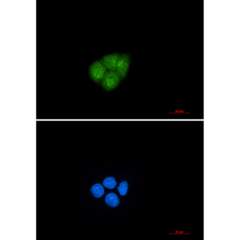 Anti-Smad2 Rabbit Monoclonal Antibody