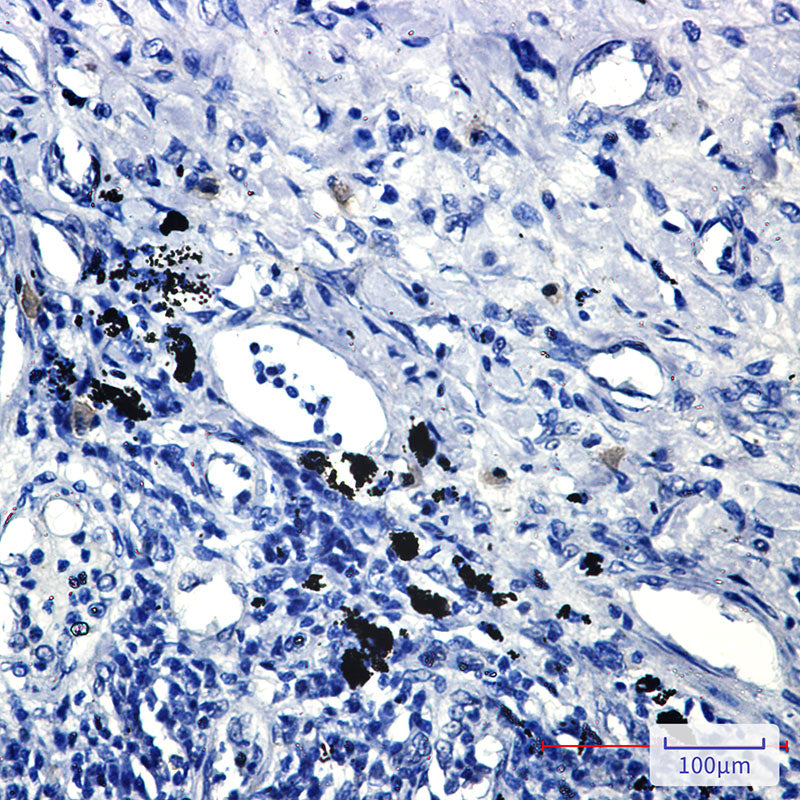 Anti-Smad2 Rabbit Monoclonal Antibody