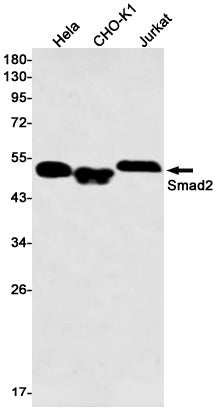 Anti-Smad2 Rabbit Monoclonal Antibody