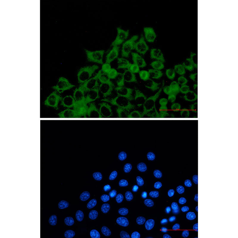 Anti-TOMM20 Rabbit Monoclonal Antibody