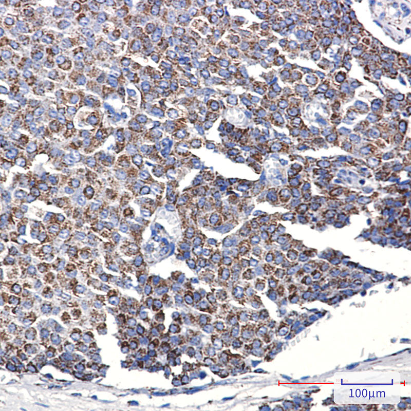 Anti-TOMM20 Rabbit Monoclonal Antibody