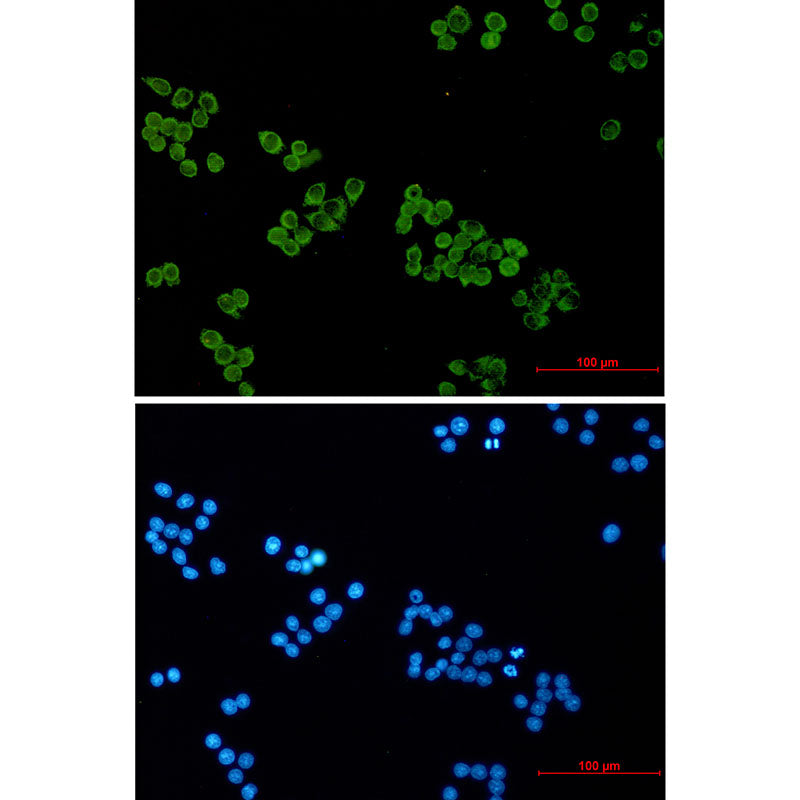 Anti-SNAP25 Rabbit Monoclonal Antibody
