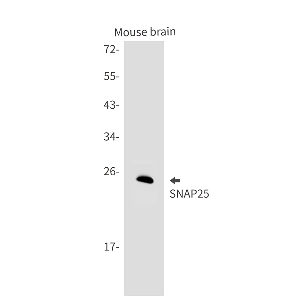 Anti-SNAP25 Rabbit Monoclonal Antibody