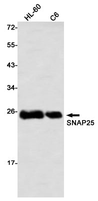 Anti-SNAP25 Rabbit Monoclonal Antibody