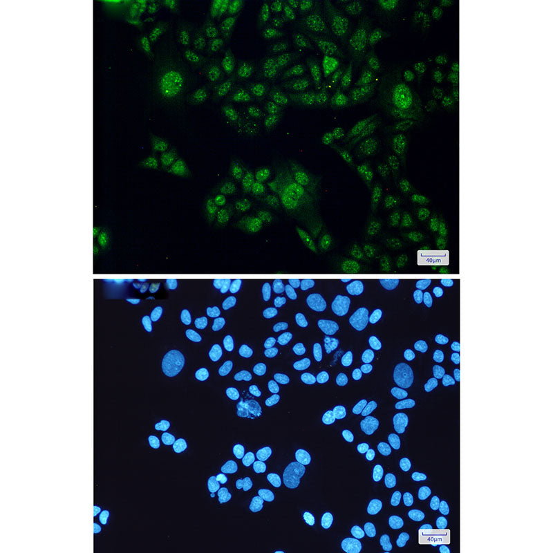 Anti-STAT3 Rabbit Monoclonal Antibody