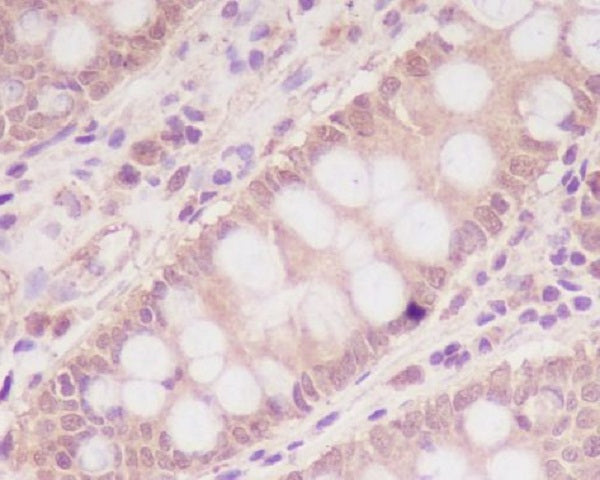 Anti-IGF2R Rabbit Monoclonal Antibody