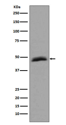 Anti-Aurora A Rabbit Monoclonal Antibody