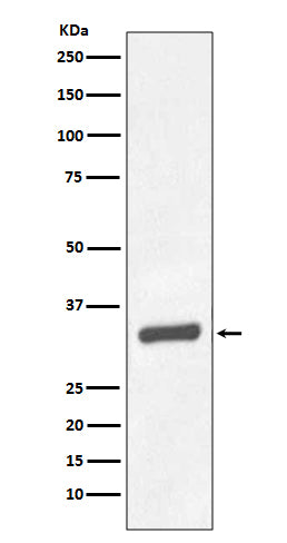 Anti-Prostate Specific Antigen Rabbit Monoclonal Antibody
