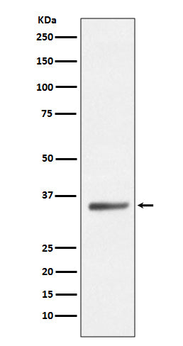 Anti-SIRT5 Rabbit Monoclonal Antibody