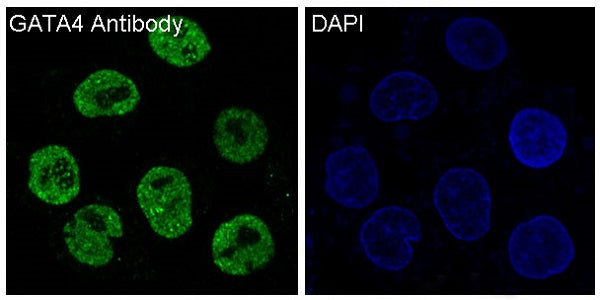 Anti-GATA4 Rabbit Monoclonal Antibody
