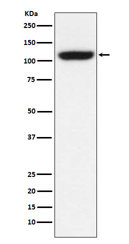 Anti-TRPM8 Rabbit Monoclonal Antibody