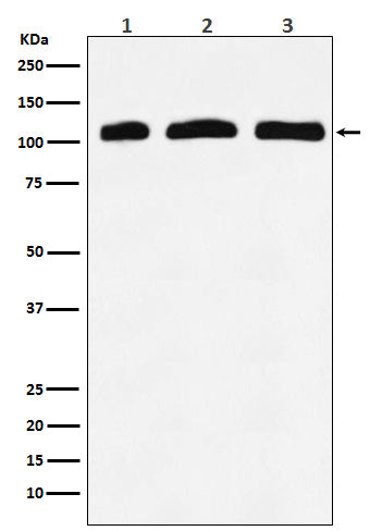 Anti-PI3 Kinase p110 delta Rabbit Monoclonal Antibody