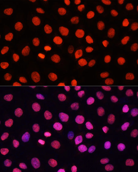 Anti-MonoMethyl-Histone H3 (Arg17) Rabbit Monoclonal Antibody