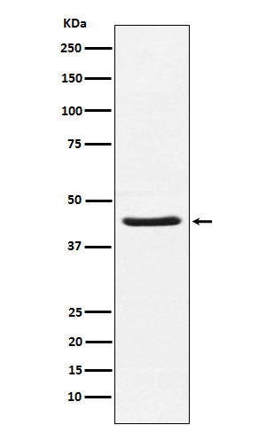 Anti-HSD3B1 Rabbit Monoclonal Antibody