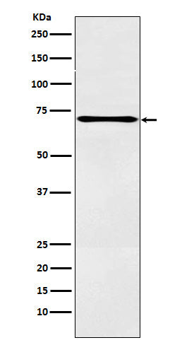 AMBP Mouse Monoclonal Antibody, capture