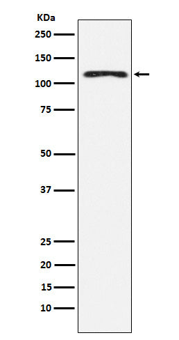 Anti-HLTF Rabbit Monoclonal Antibody