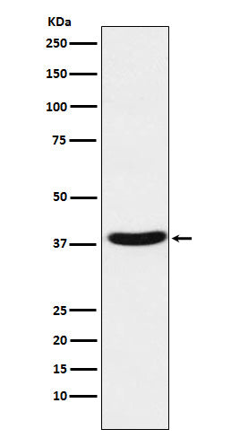 Anti-MT ND1 Rabbit Monoclonal Antibody